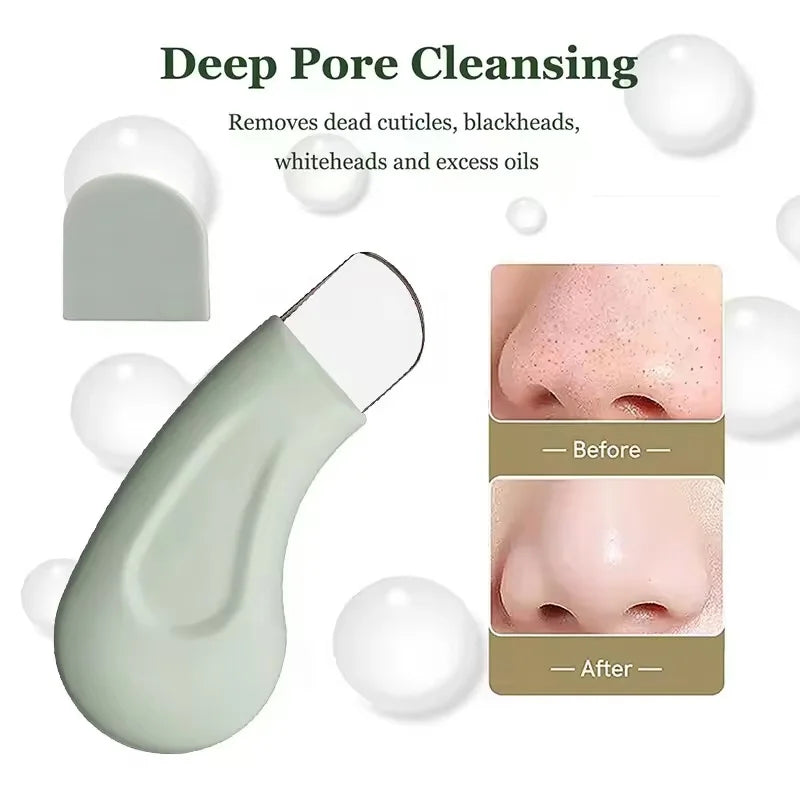 ✨ Extractor de Puntos Negros y Limpiador de Poros Facial